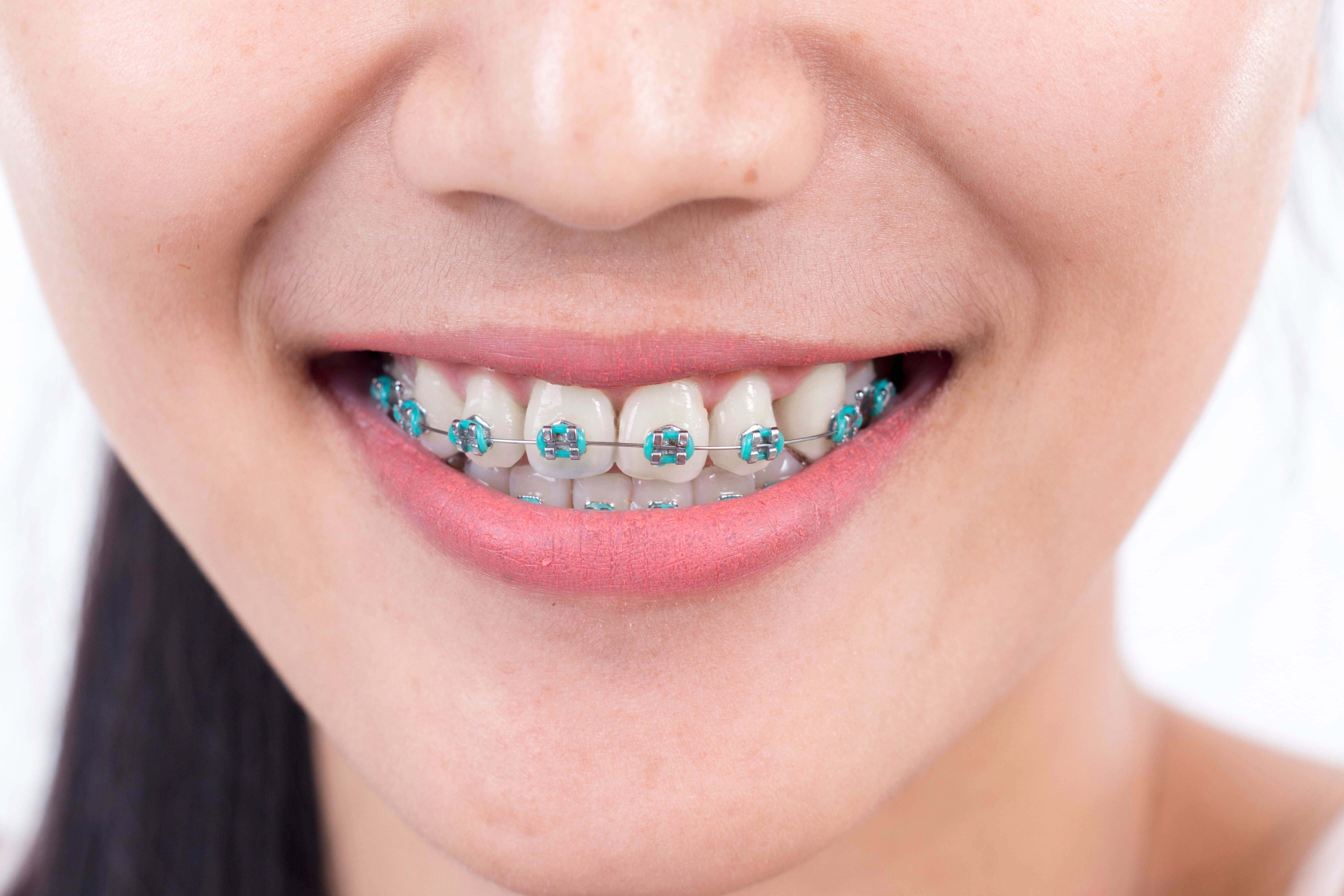 An uncommon dental trait lives on
