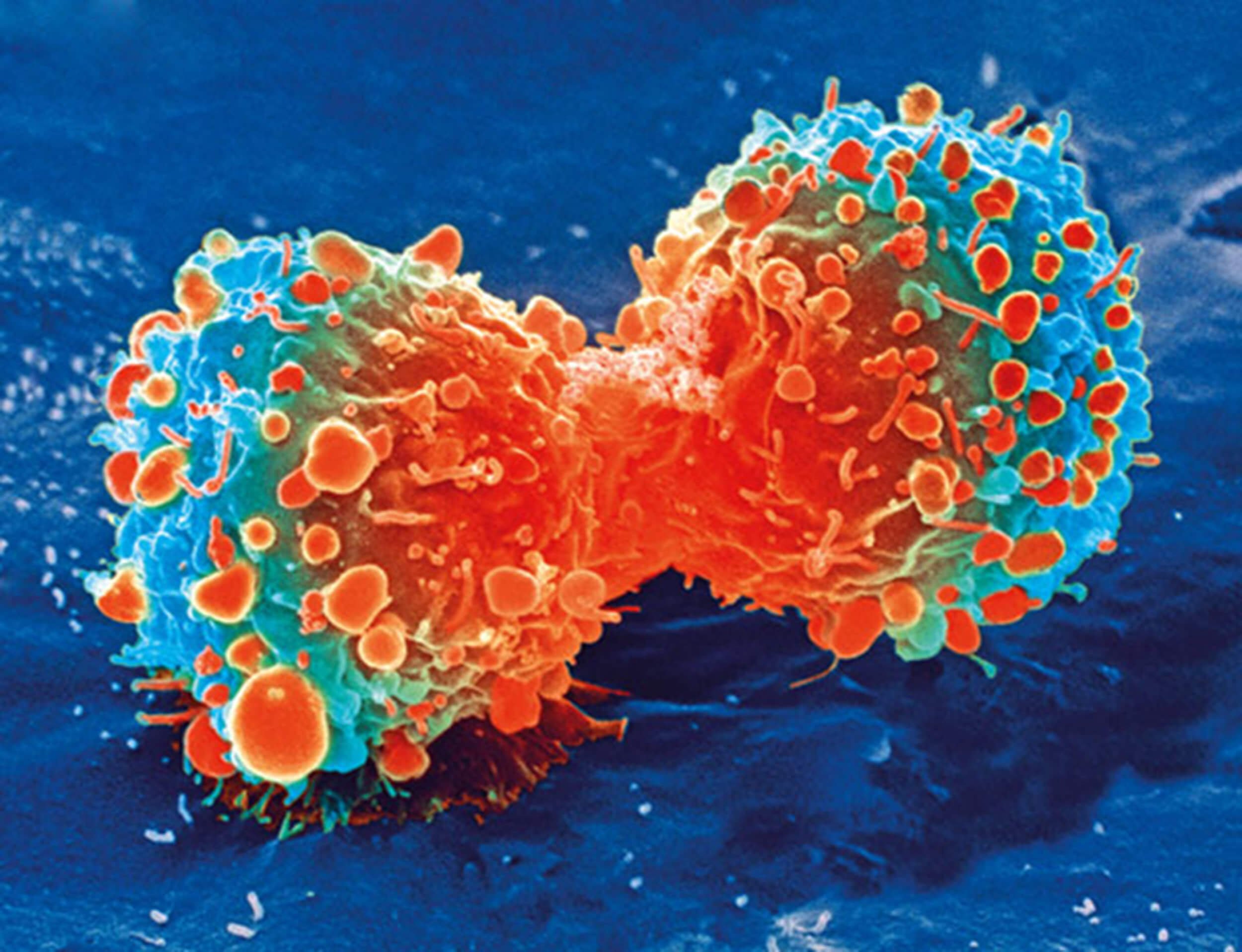 Could lead to higher remedies for metastatic cancers