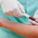 Blood Test May Be Able To Predict Breast Cancer Relapse