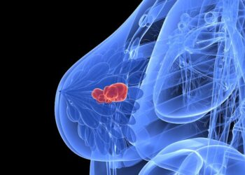 The 8 Breast Cancer Guidelines to Remember