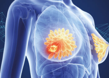 10 Breast Cancer Facts You Should Know About