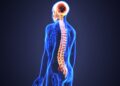 Spinal Cord Injury – What Happens During an Accident?