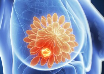 How To Find Breast Cancer Lumps – How Can I Avoid This In the Future?