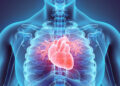 Take Cholesterol to Heart