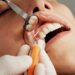 Plastic Free Swaps on your Dental Routine