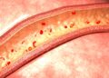 Metformin indicates promise for vascular health