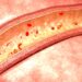 Metformin indicates promise for vascular health
