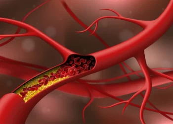Non-HDL Cholesterol a CV-Risk Crystal Ball for Young Adults