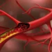 Cholesterol Good And Bad
