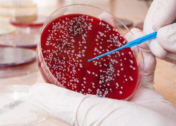 Similarities of small mobile cancers to blood cancers should result in higher treatments