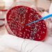Similarities of small mobile cancers to blood cancers should result in higher treatments