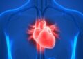 Takotsubo Syndrome – Is This a Real Thing?