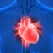 Takotsubo Syndrome – Is This a Real Thing?