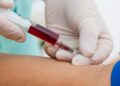 Breast most cancers: Blood test may additionally predict relapse