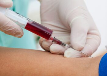 Breast most cancers: Blood test may additionally predict relapse