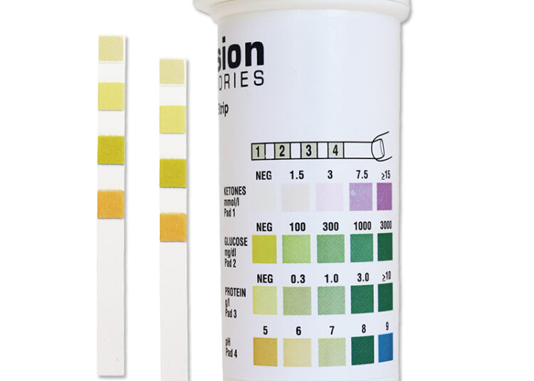 Understanding Test Strip Urinalysis for Quick Health Checks